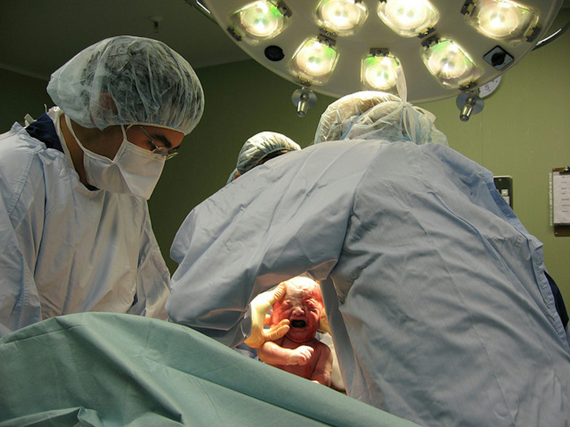 photo of vaginal operations Sexy c cups